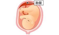 胎盤